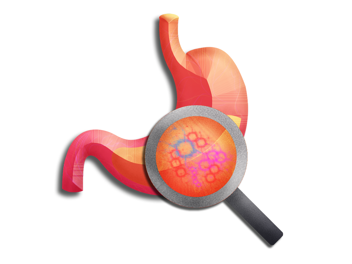Gut Zoomer Test by Vibrant America – CrohnsColitisLifestyle